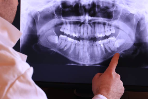 Best Emergency Dental Services for Seniors in Oxoboxo River, CT